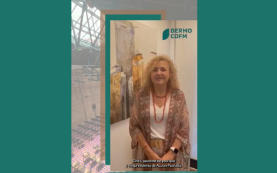 Montserrat Ginés paciente de psoriasis y vecipresidenta de Acción Psoriasis participará junto a organizaciones y asociaciones de pacientes dermatológicos el 4 y 5 de octubre en las jornadas de DermoCOFM del Colegio Farmacéuticos de Madrid.